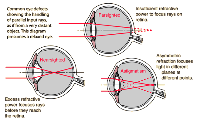 Nearsighted Eye Chart